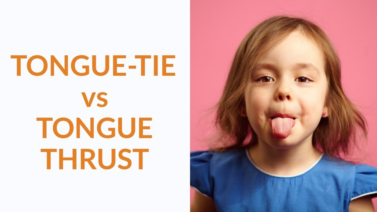 Tongue-Tie vs. Tongue Thrust - What's The Difference?