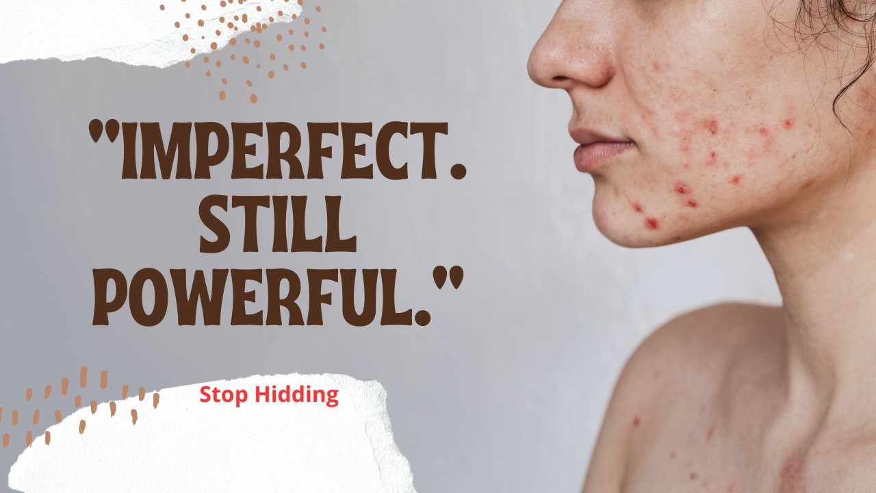 I Stopped Hiding My Acne | Imperfect But Powerful