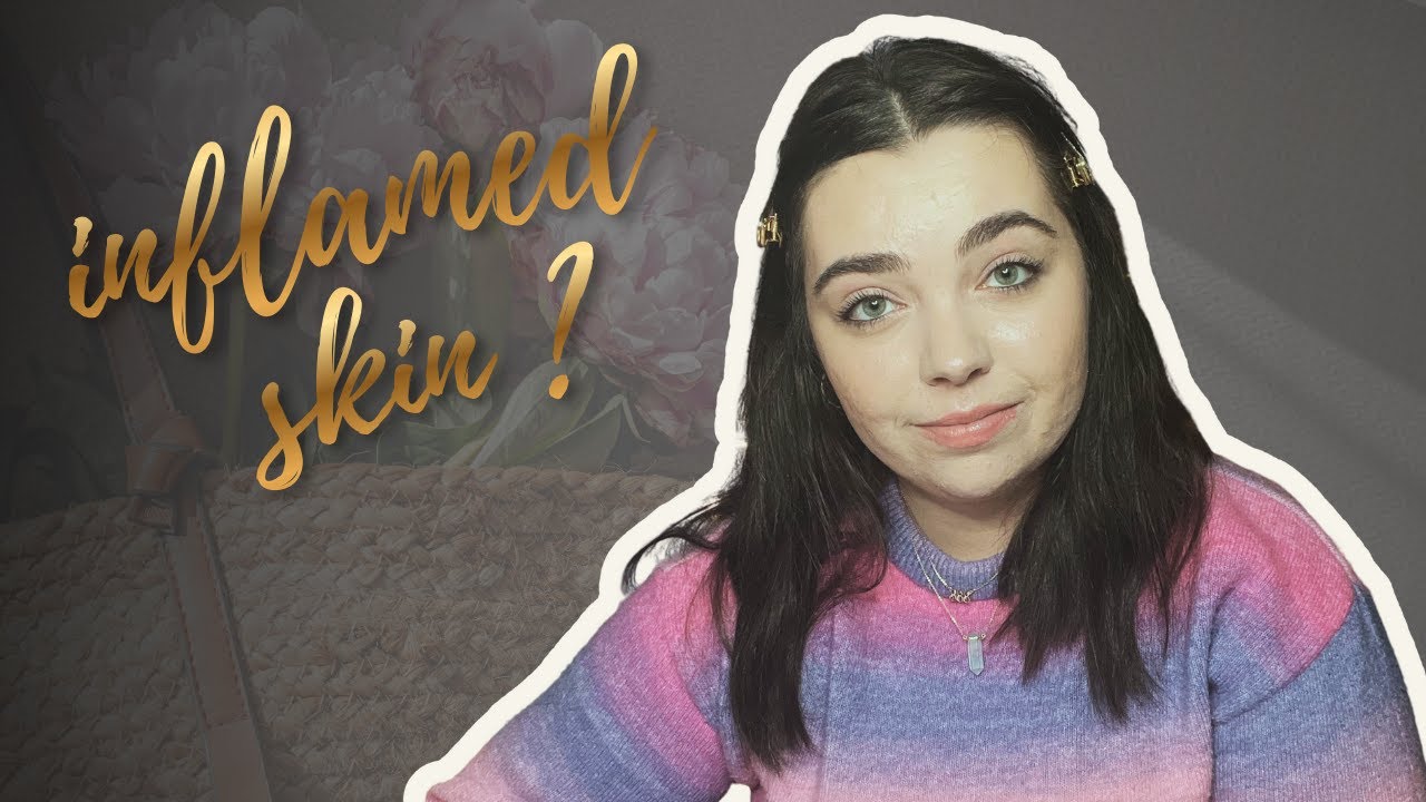 How to Clear Inflamed Skin in 2026 (Acne, Rosacea & Sensitive Skin) 🤍 A Gentle Holistic Routine