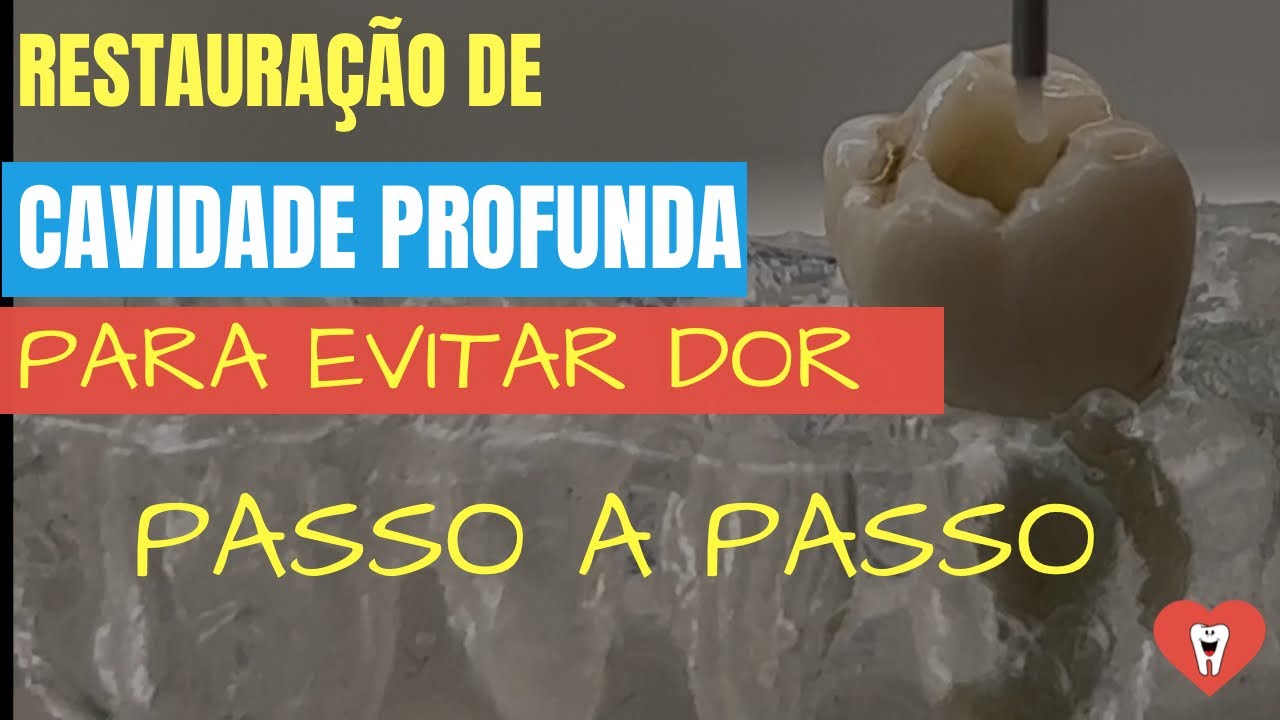 PROTOCOLO PARA EVITAR DOR EM RESTAURA&Ccedil;&Atilde;O EM C&Aacute;RIE PROFUNDA