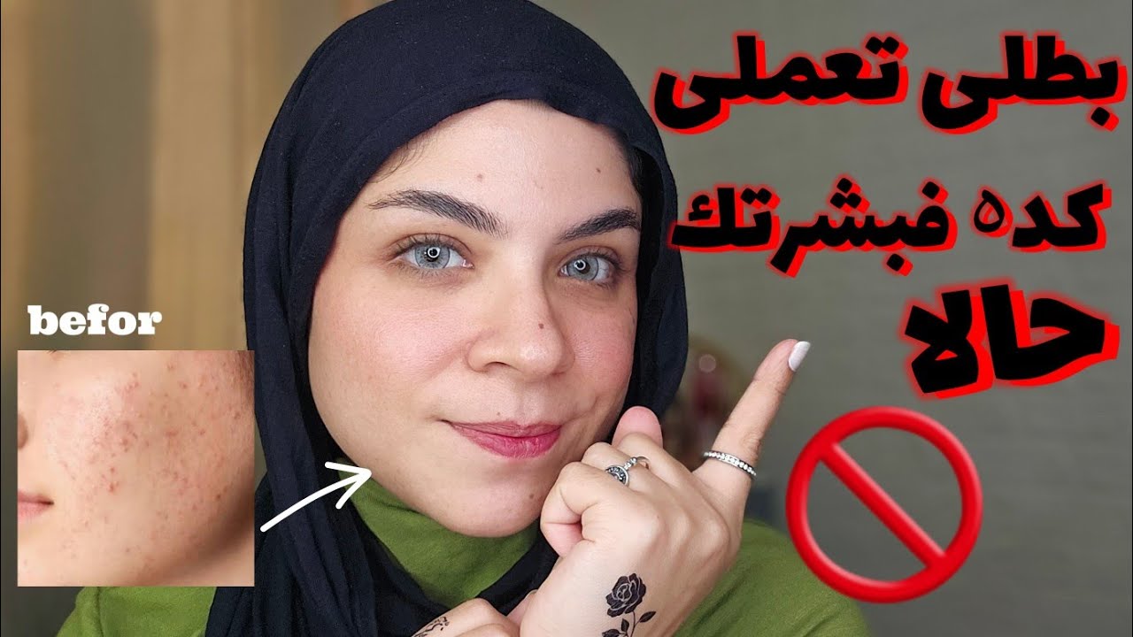 غلطانه لو فاكره انك كده بتهتمى ببشرتك 🙆‍♀️انتى بتدمريها🤦‍♀️ وقفى فورا 🚫 الحبوب والبقع هتختفى😉