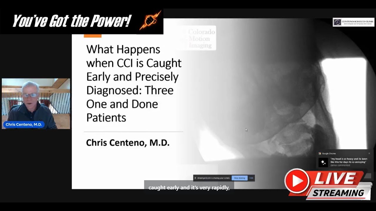 What Happens when CCI is Caught Early and Precisely Diagnosed?