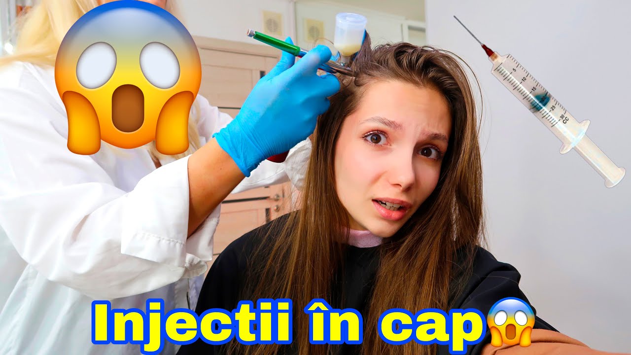 Injectii în Cap 😨 / Proceduri pentru Par foarte Dureroase