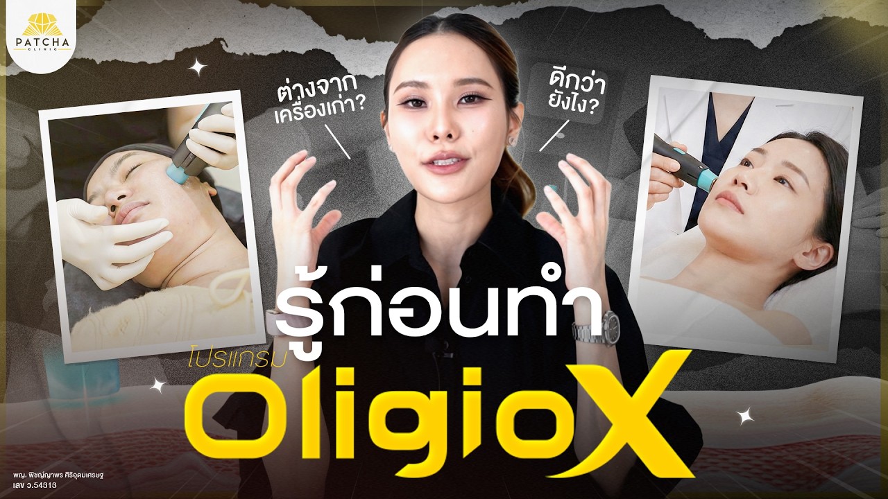 Oligio X คืออะไร ต่างจากรุ่นเดิมอย่างไร เหมาะกับใครบ้าง