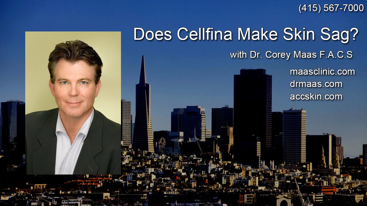 The Cellulite Cure - Does #Cellfina Make Skin Sag?