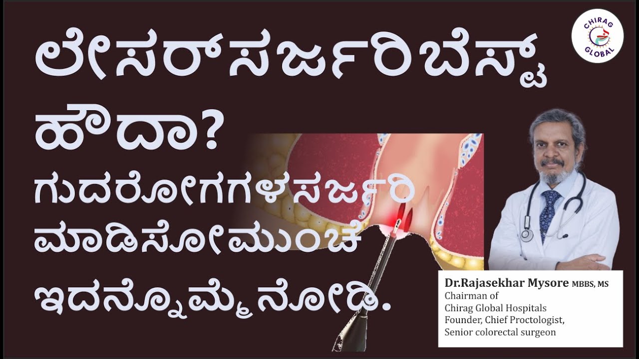 ಲೇಸರ್ ಸರ್ಜರಿ ಬೆಸ್ಟ್ ಹೌದಾ? | 📞8867546900 Dr. Rajasekhar Mysore | Chirag Global Hospitals