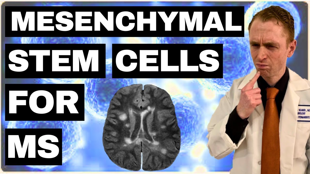 Mesenchymal Stem Cells for MS Explained by Neurologist