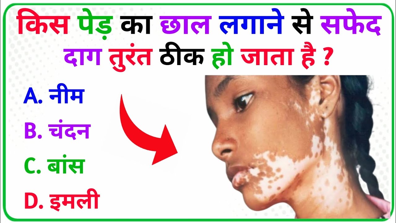 GK Questions || GK Quiz || GK in Hindi || GK Questions and answer || gk today || ms gk quiz ||
