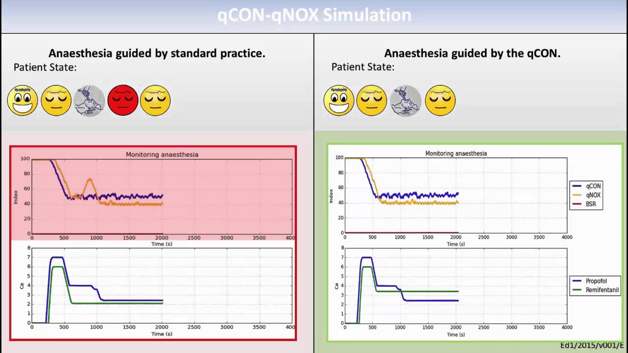 qNOX: Avoiding Risk