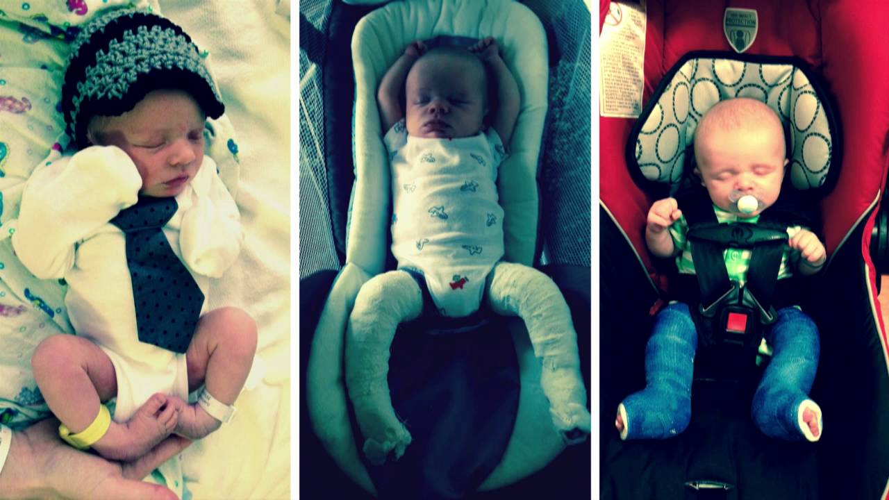 Wyatt's Story - Winning the Fight Against Clubfoot