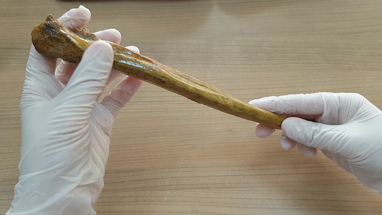Ulna ve Radius Anatomisi (Ön kol kemikleri)