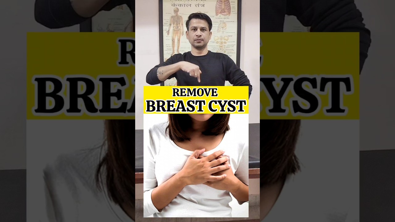 Best Exercise for Remote Breast Cyst #shorts #tranding #exercise