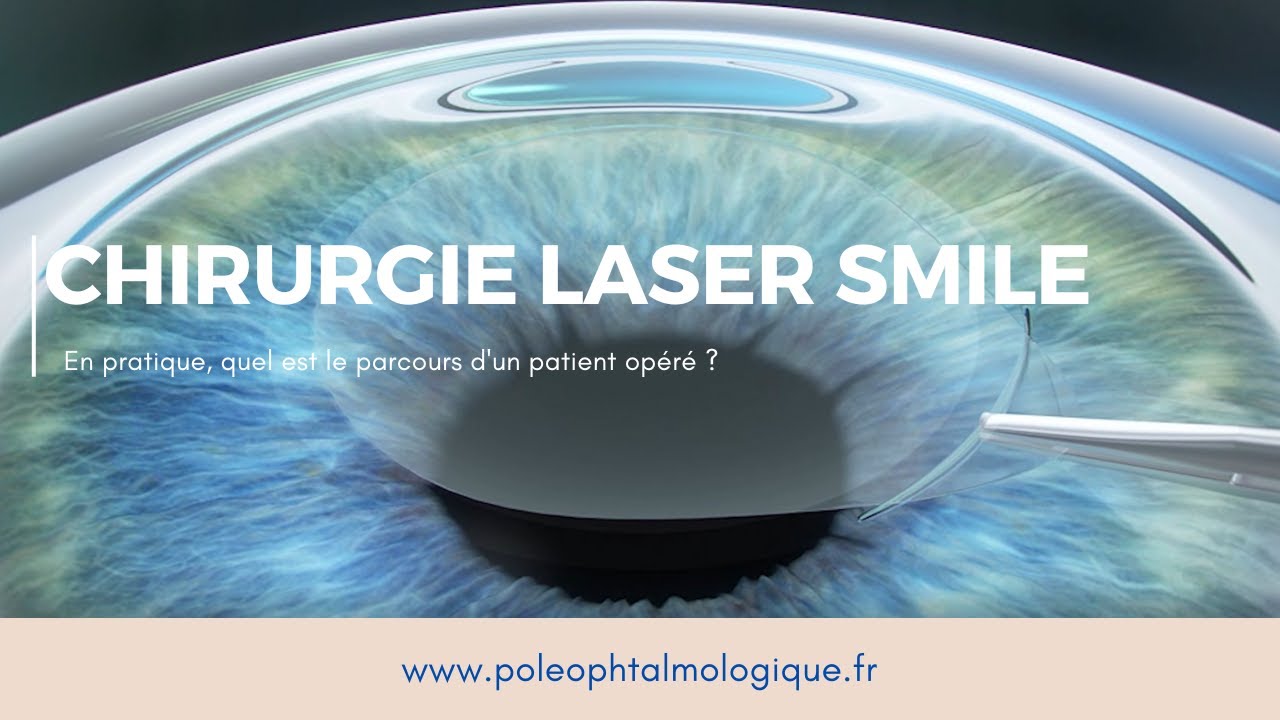 Chirurgie réfractive laser SMILE. Pole Ophtalmologique.