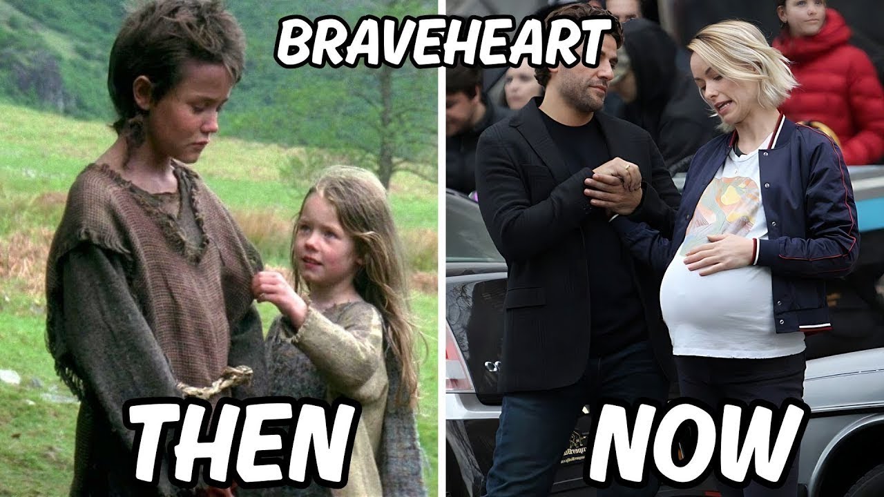 Braveheart 1995 Cast: Then vs Now 🔥 (2026)
