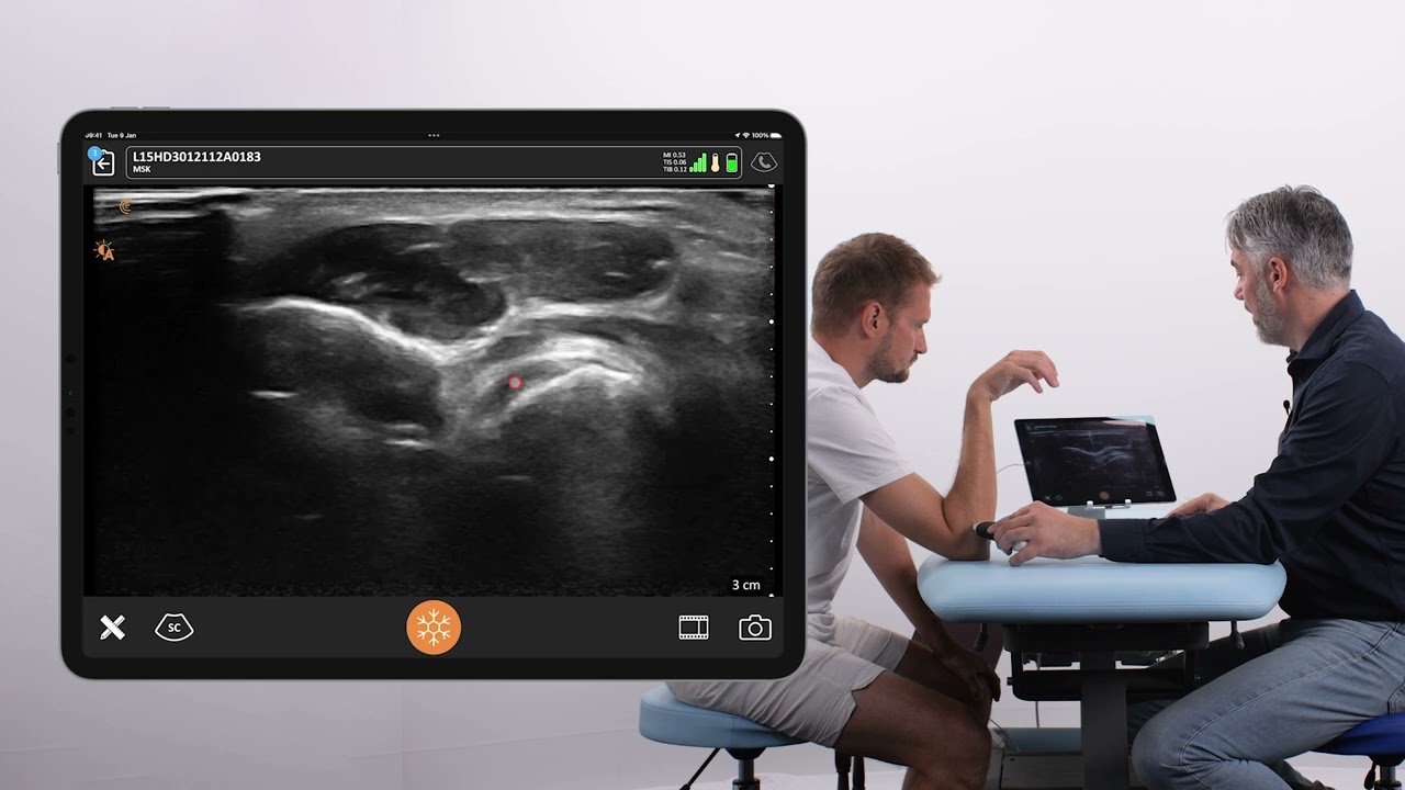 Scanning the Distal Biceps Tendon: Dorsal Approach