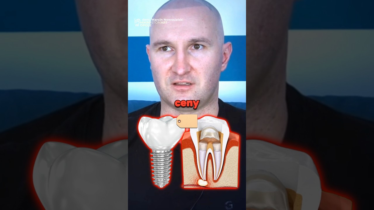 Leczenie Kanałowe Droższe Od Implant&oacute;w? 📈🦷 Dentysta: TREND SIĘ ODWRACA! (A DENTYŚCI WOLĄ SW&Oacute;J ZĄB!)