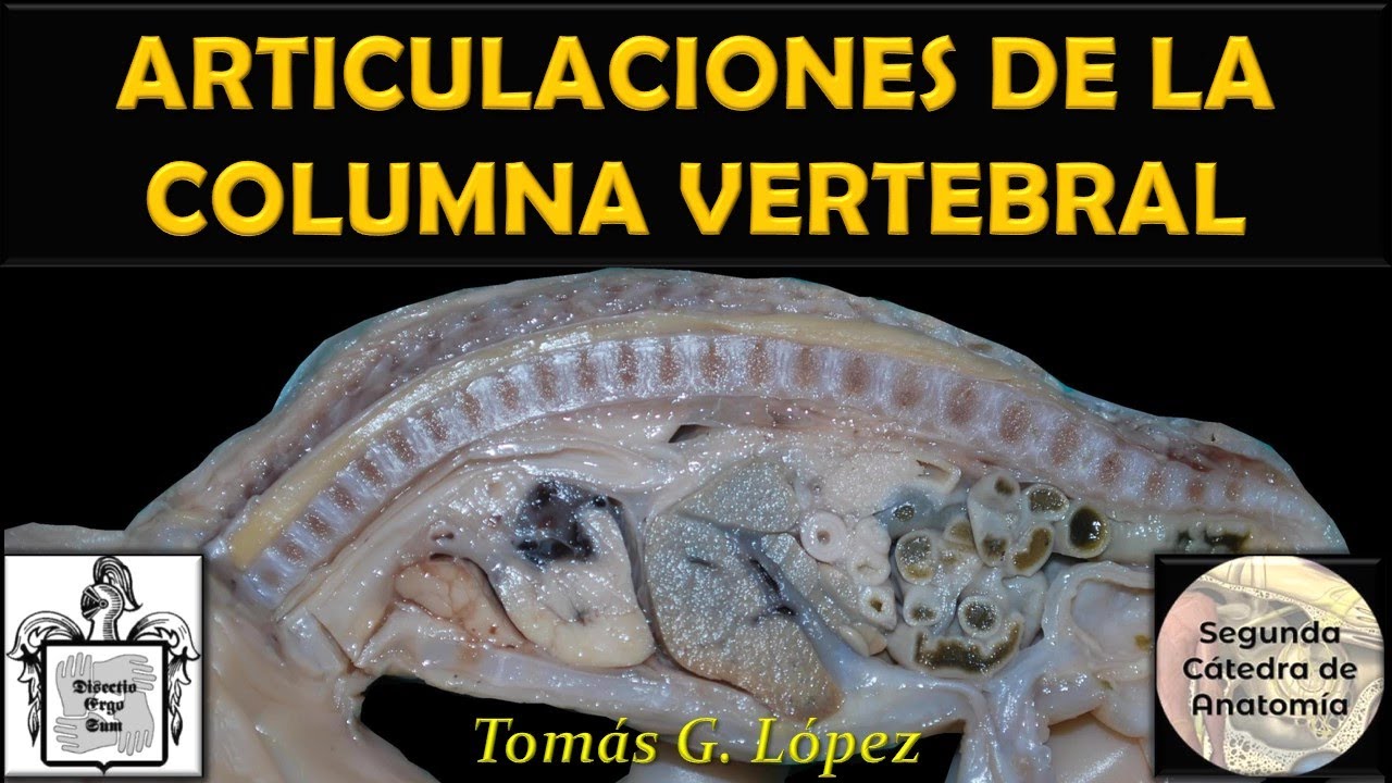 L1.2 | Anatomía en Fotografías - Articulaciones de la columna vertebral | Anatomía 2 | FMed UBA