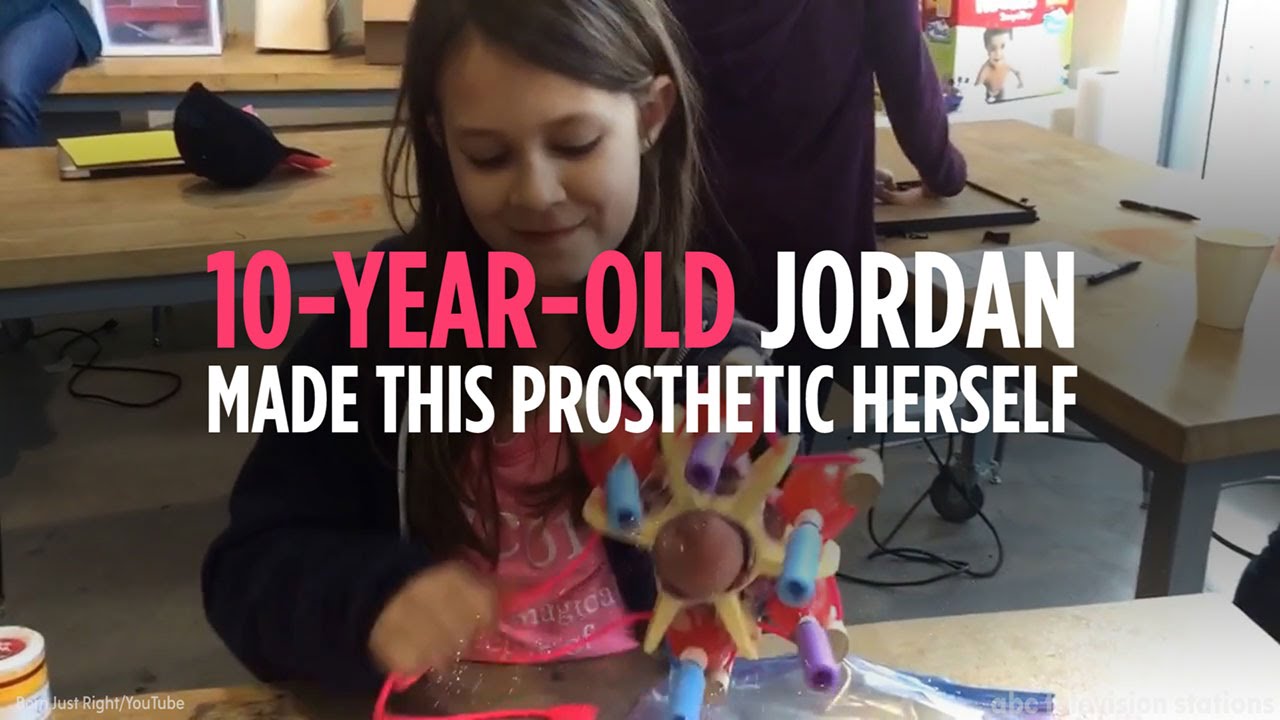 10-year-old born without full arm creates glitter-shooting prosthetic
