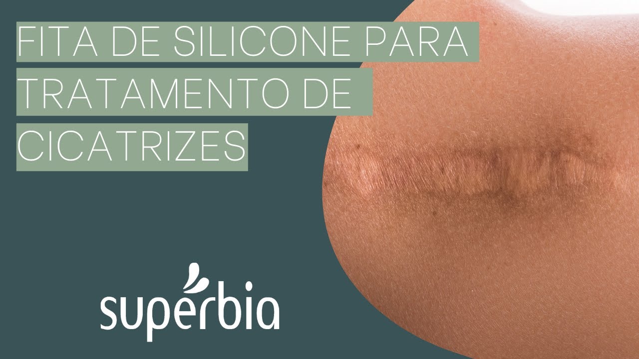 Fita de Silicone para Cicatriz Supérbia | Tratamento RÁPIDO, EFICAZ e COMPLETAMENTE INDOLOR