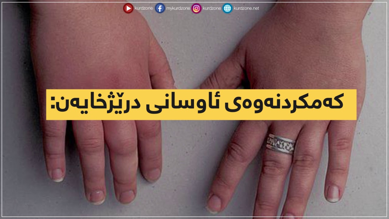 سوودەکانی خواردنی ساوار
