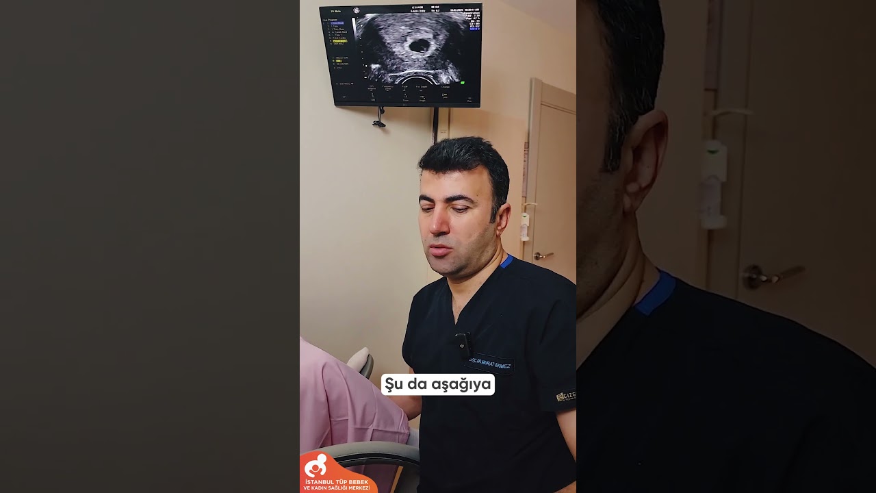 Süpri̇z Tek Yumurta İki̇zi̇ I Doc. Dr. Murat Ekmez