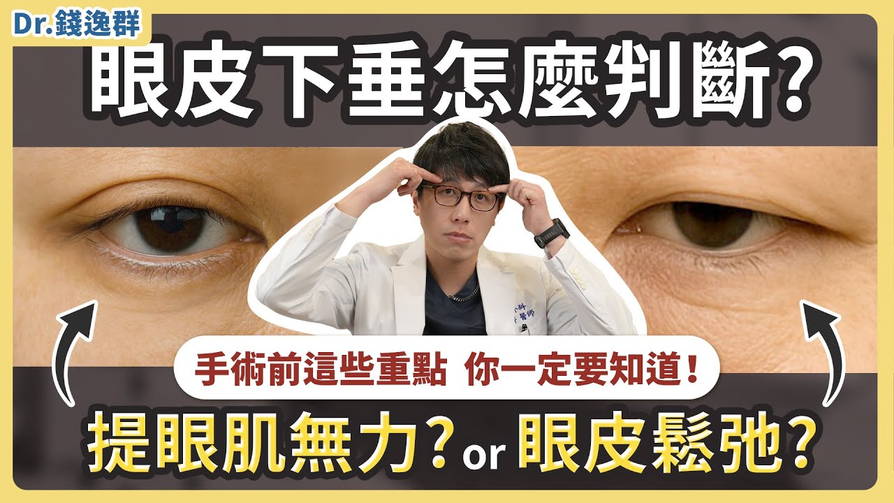 眼皮下垂？是提眼肌無力還是眼皮鬆弛？手術前這些重點你一定要知道！| feat. 整形外科 錢逸群 醫師