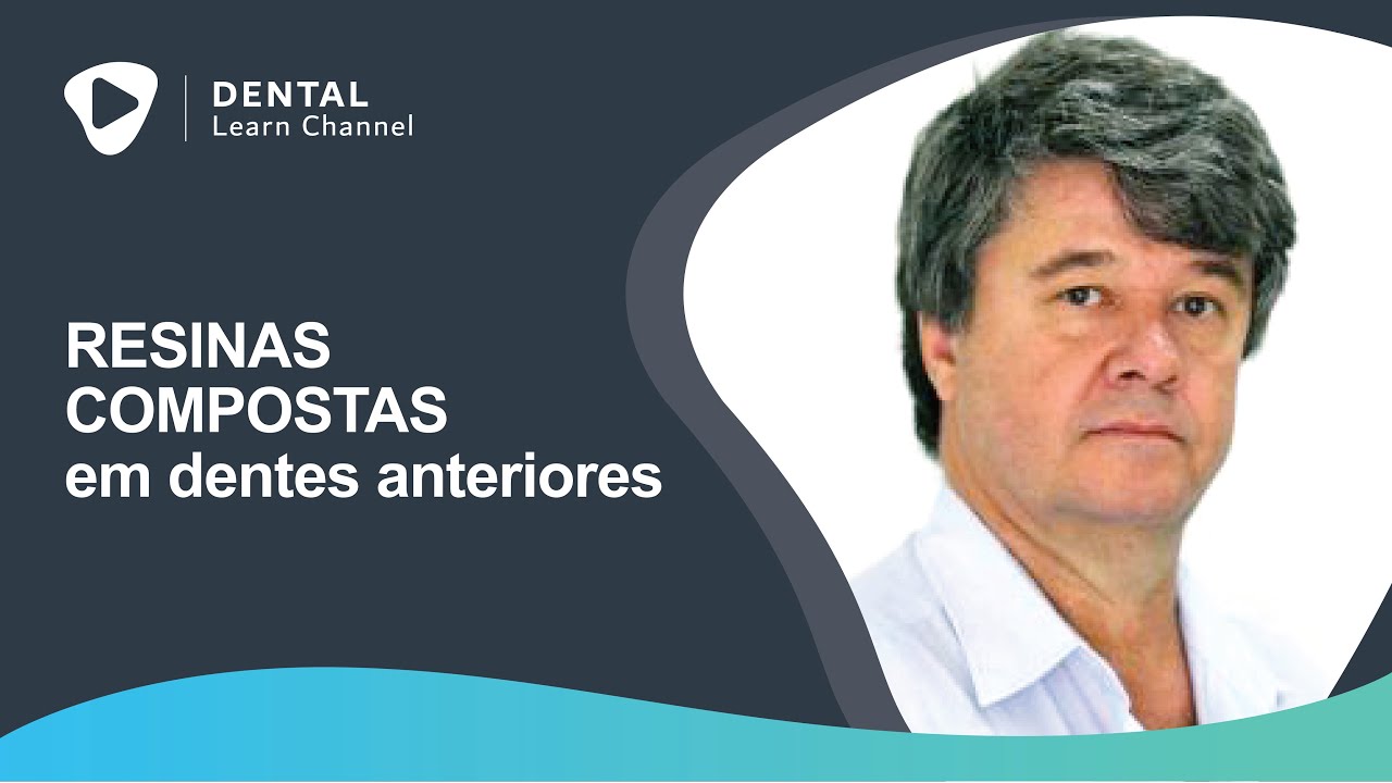 Resinas compostas em dentes anteriores (Prof. Dr. Eduardo Lemos de Souza).