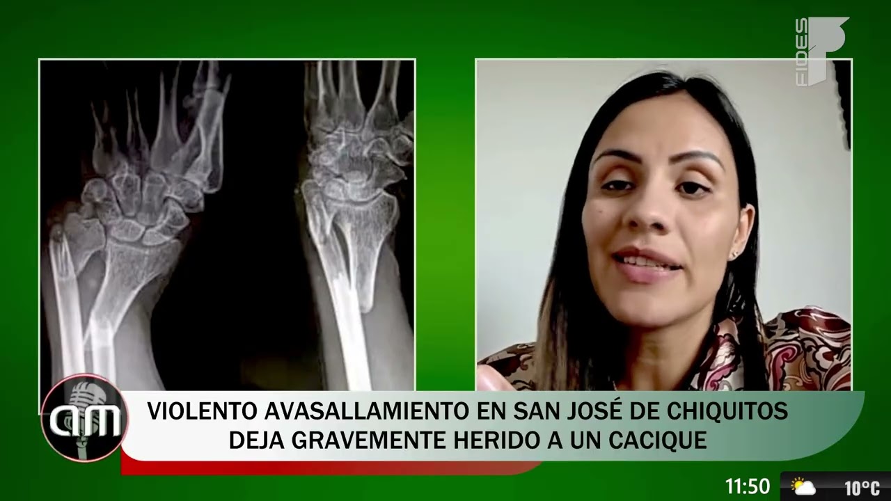 🟢 Avasallamiento en San José de Chiquitos deja herido a cacique del lugar |20.01.26|