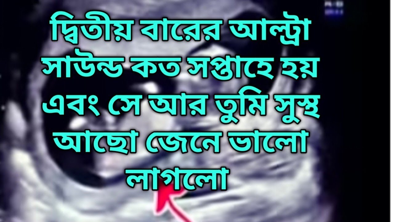 এতো মানুষের আশির্বাদ তোমার মাথার উপর আছে অতএব ভালো হবে আর টিনু শুনে নাও national qu@DiptiDebnath2.0 