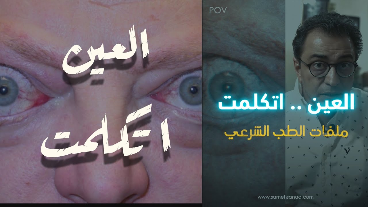 العين اتكلمت !! | ملفات الطب الشرعي