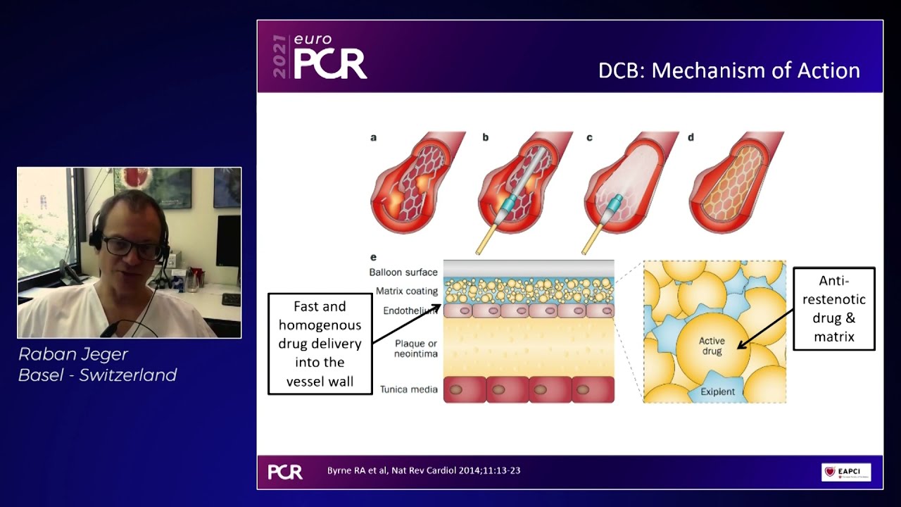 Paclitaxel and sirolimus coated balloons: create evidence before claims - EuroPCR 2021