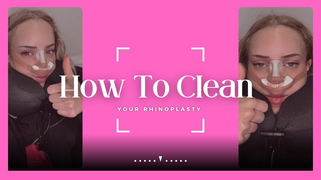 how to clean your nose job! 🩹👃🏼