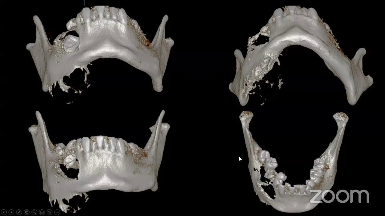 Sinergia entre la tomografía 3D cone beam y la práctica dental moderna