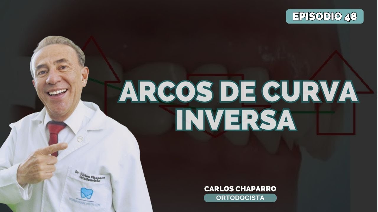 Arcos de curva inversa - Episodio 48