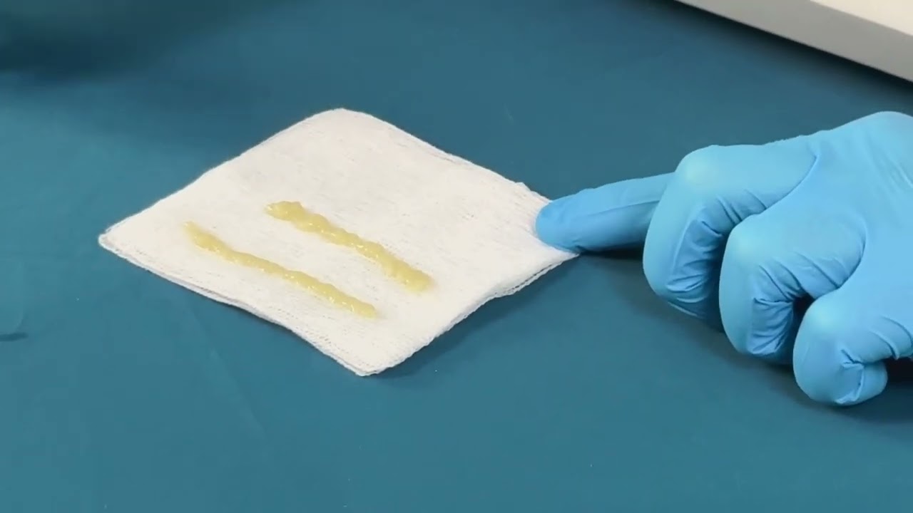 Optimizing PRF Delivery: Comprehensive Needle Flowability Demonstration for Clinical Applications