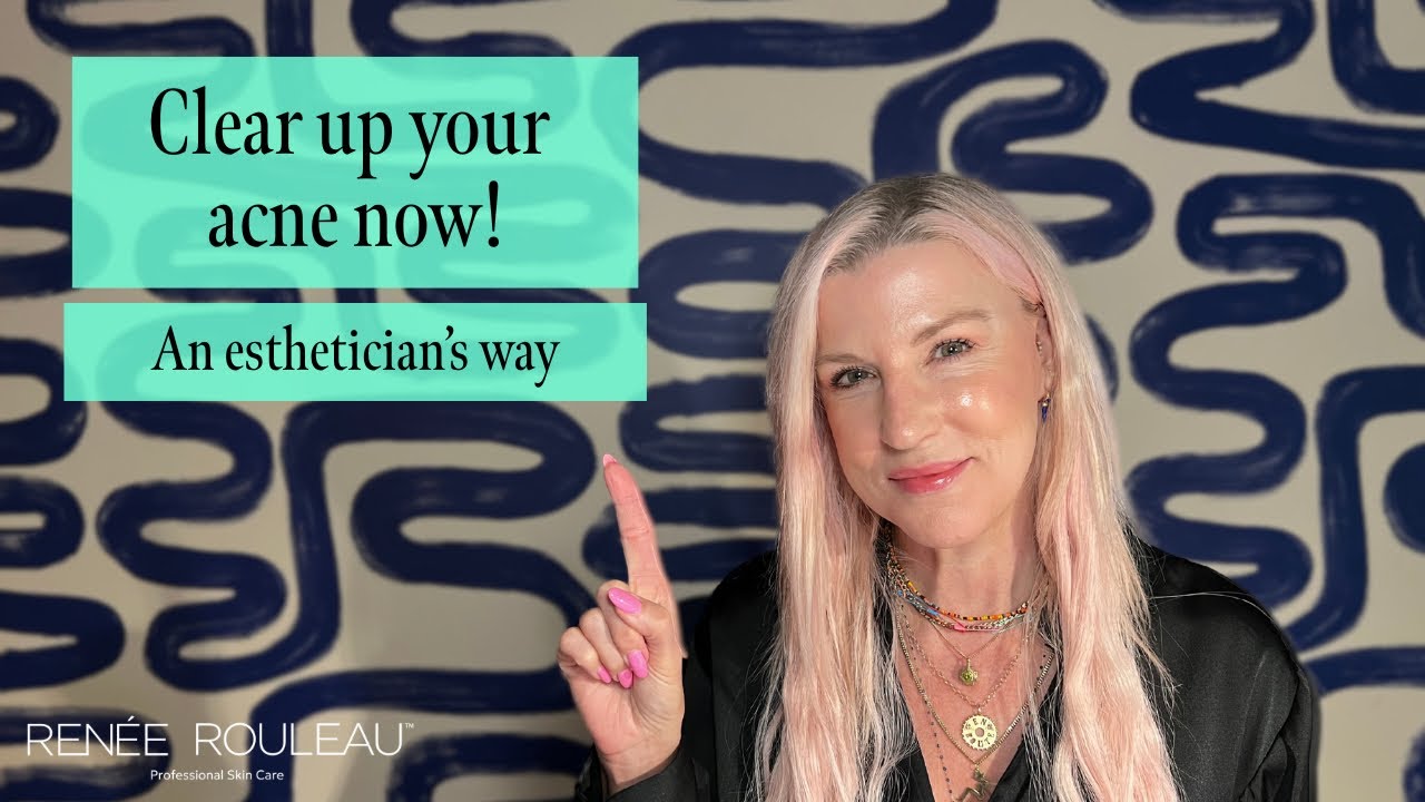 How to get rid of acne—an estheticians way