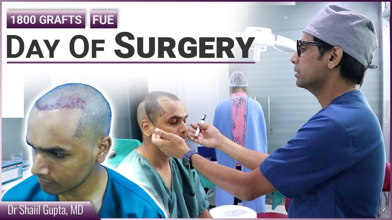 FUE | Hair Transplant Surgery Live | Live FUE surgery | FUE Hairline Design | FUE Hair Transplant