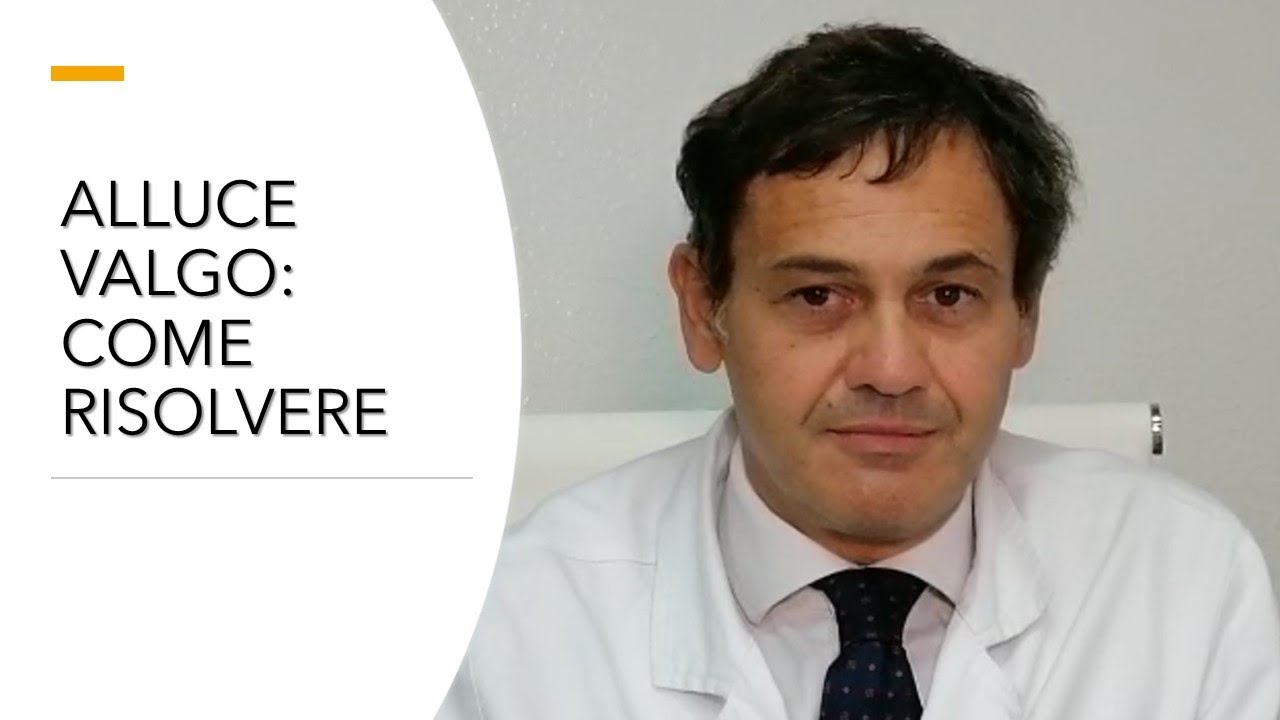 ALLUCE VALGO: COME RISOLVERE?