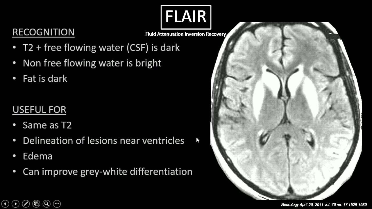 MRI Sequences