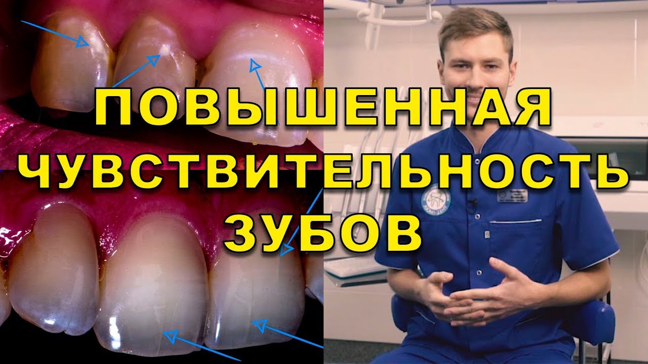 Повышенная чувствительность зубов - Киев, Люми-Дент (Видео)