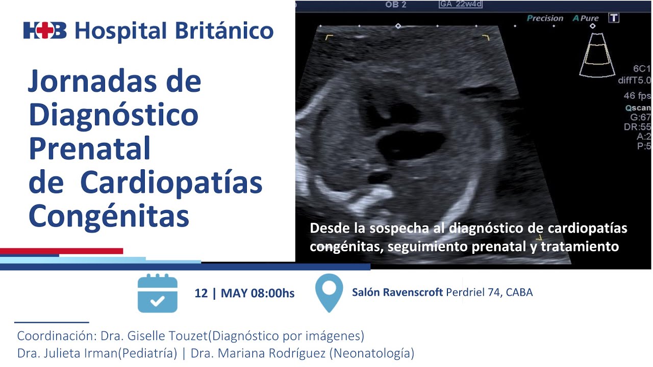 Jornadas de Diagnóstico Prenatal de Cardiopatías Congénitas