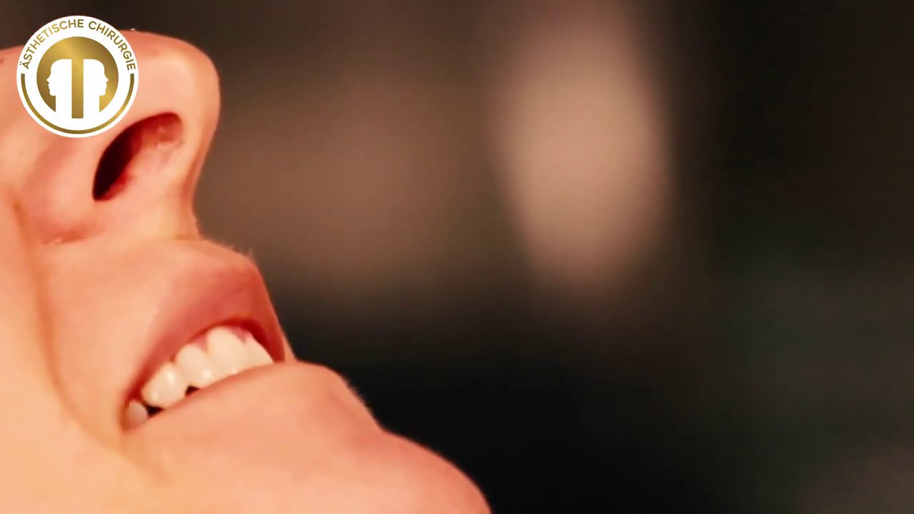 Lippenfalten mit Botox | vom Privatdozenten behandelt | Mc Aesthetics