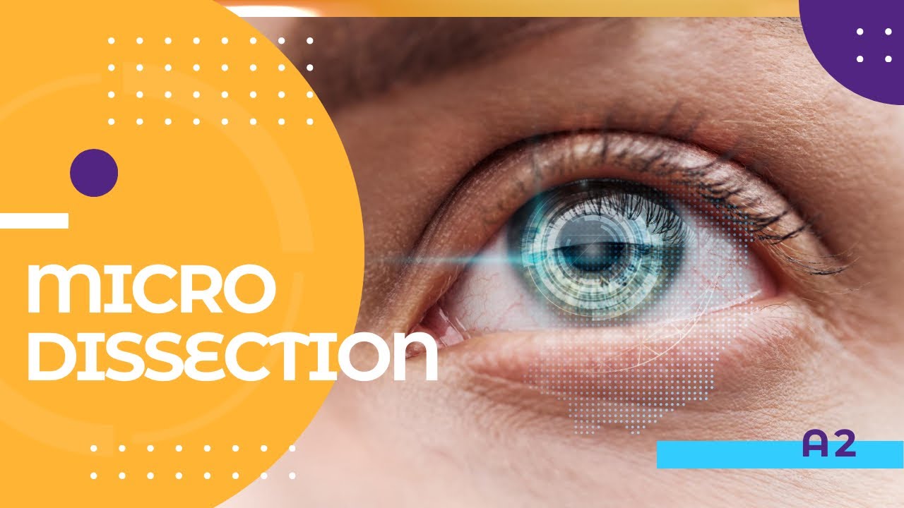MICRODISSECTION | TYPES OF MICRODISSECTION | CLASS 11 BIOLOGY | BIOLOGY
