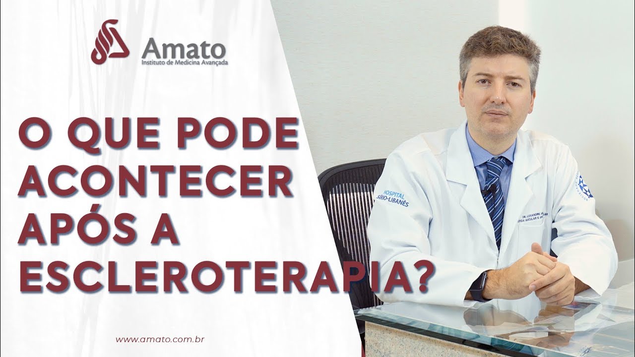 O Que Pode Acontecer Após a Escleroterapia?