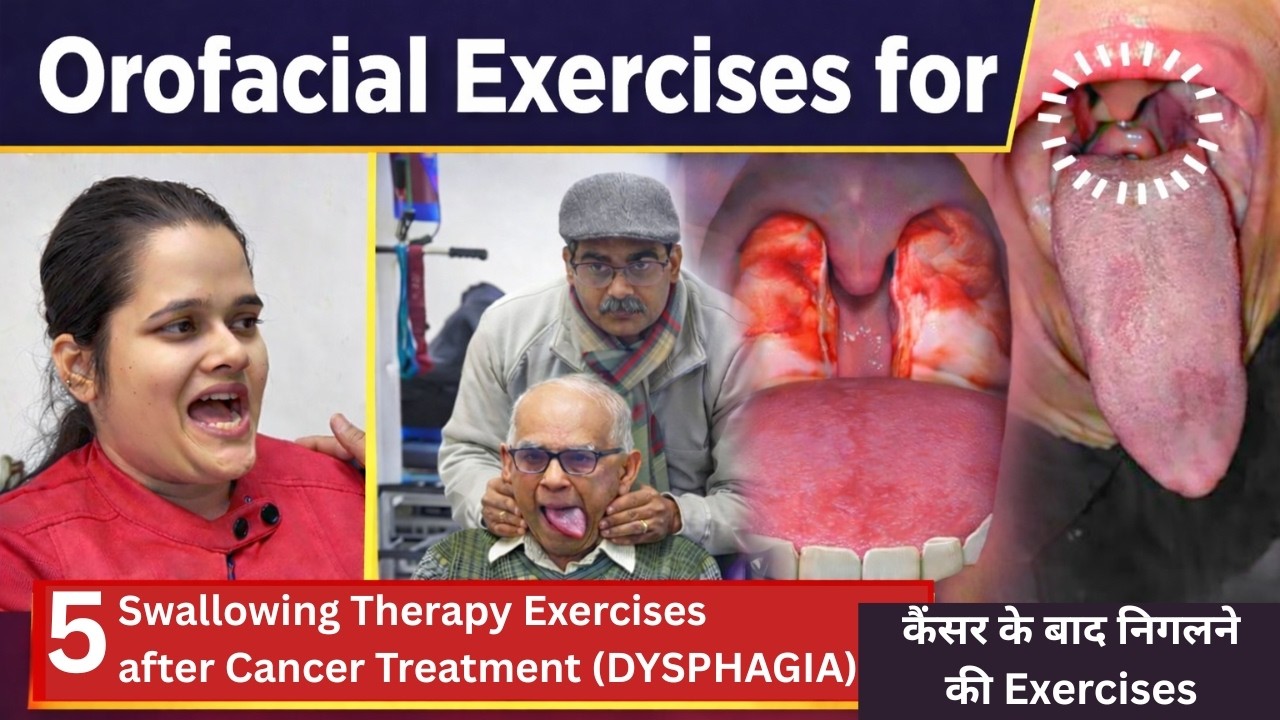 Orofacial Exercises for Swallowing After Cancer Treatment | Dysphagia Exercises