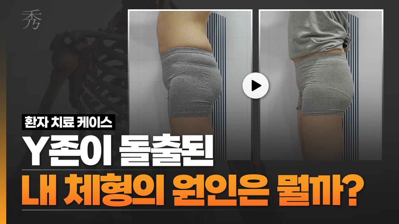 Y존이 돌출된 내 체형의 원인을 찾아보자!