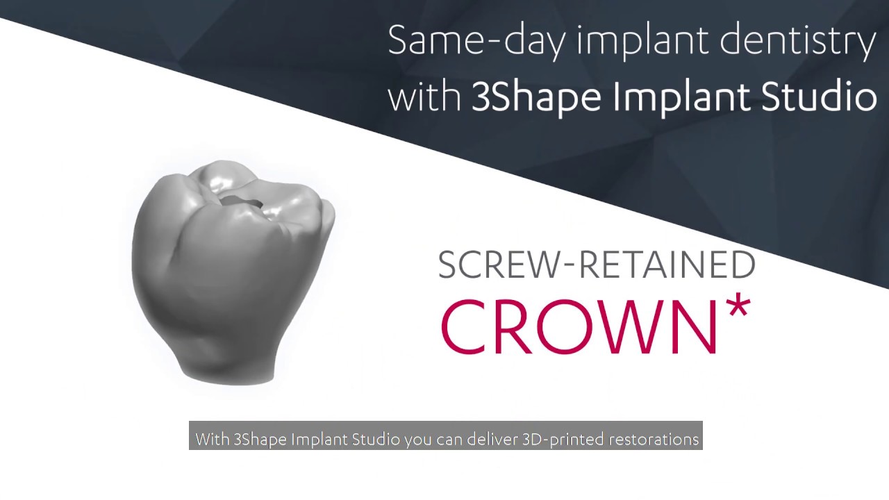 Same-day implant dentistry with 3Shape Implant Studio 2019