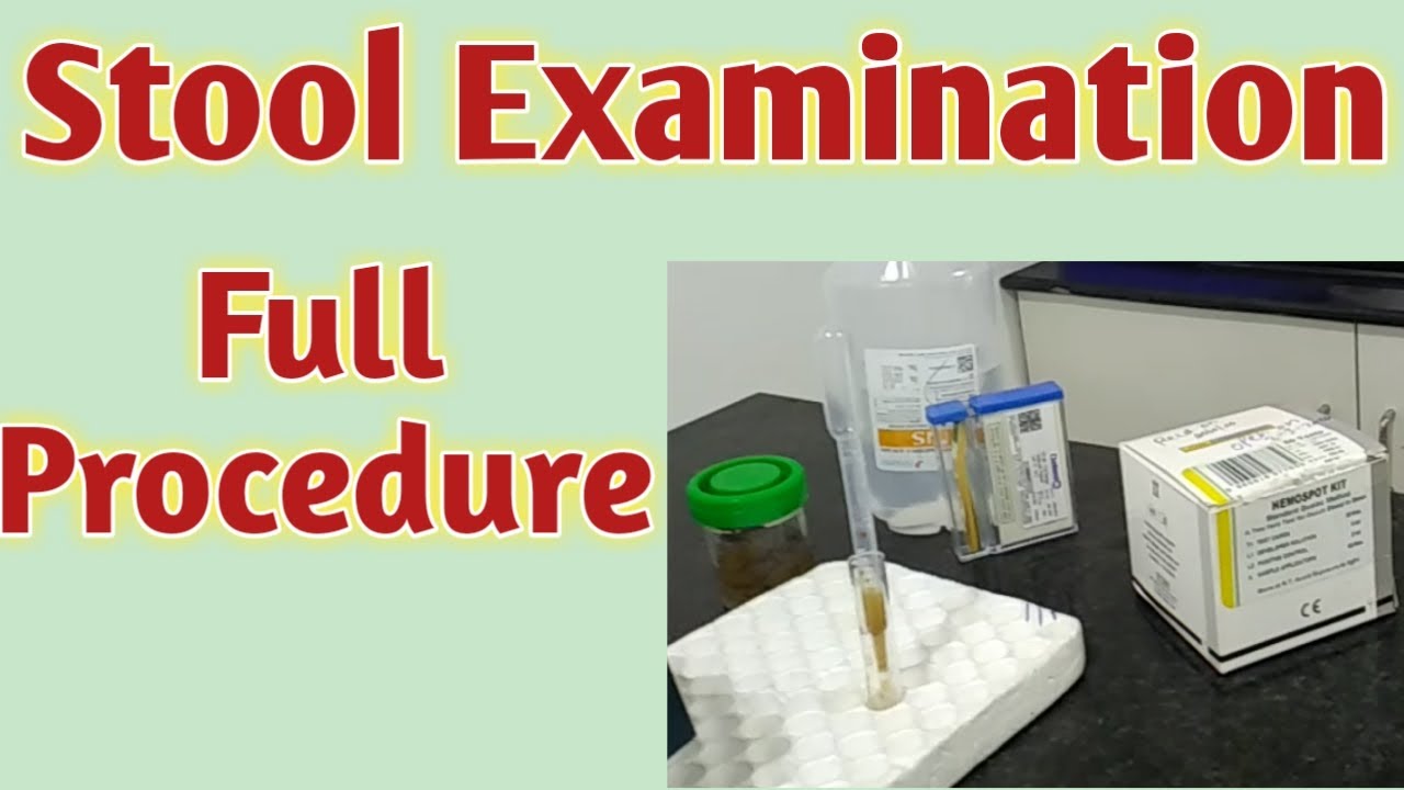 Stool examination | Stool microscopic examination | Stool examination in hindi |Stool test procedure