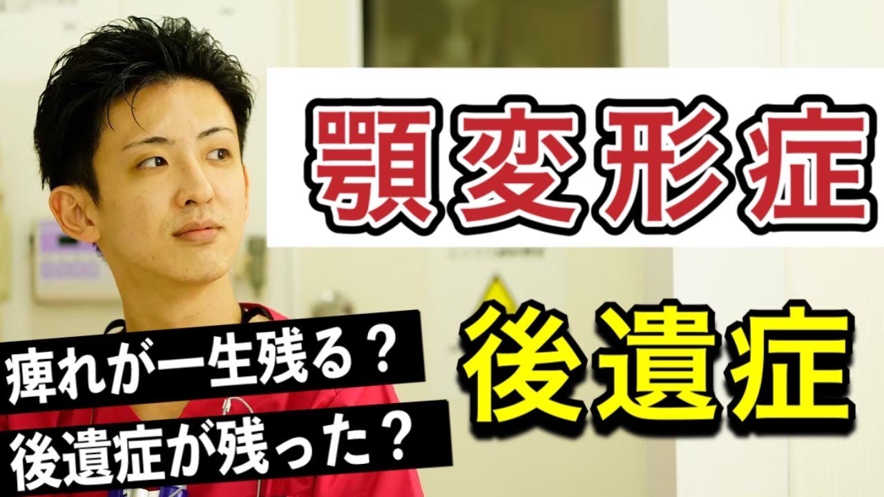 【顎変形症】手術したら痺れが残るって本当？？【知覚麻痺を徹底解説】