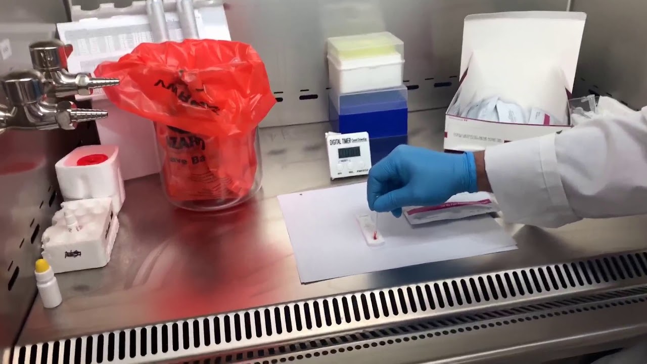 Biocan COVID 19 IgG/IgM Ab Whole Blood Test Demo